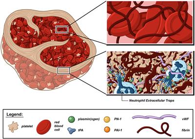 Composition and Organization of Acute Ischemic Stroke Thrombus: A Wealth of Information for Future Thrombolytic Strategies